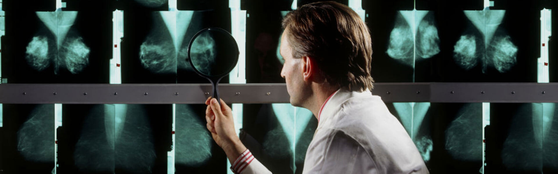 4 Breakthroughs in Breast Cancer Treatment