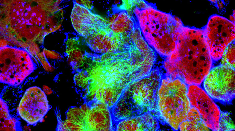Media Name: cancer-cells_gettyimages_575x354.jpg
