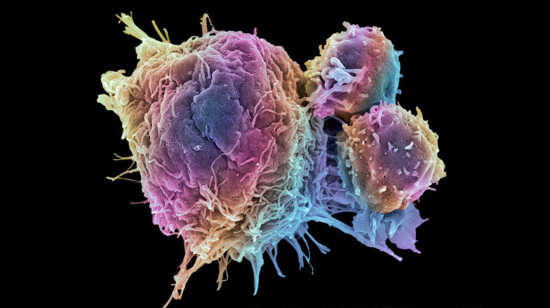 cancer_cell_and_t_lymphocytes_sem_785x440