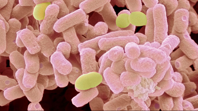 e.coli_gettyimages-99310938-785x440.jpg 