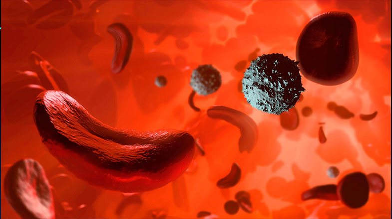 How I Became A Sickle Cell Warrior