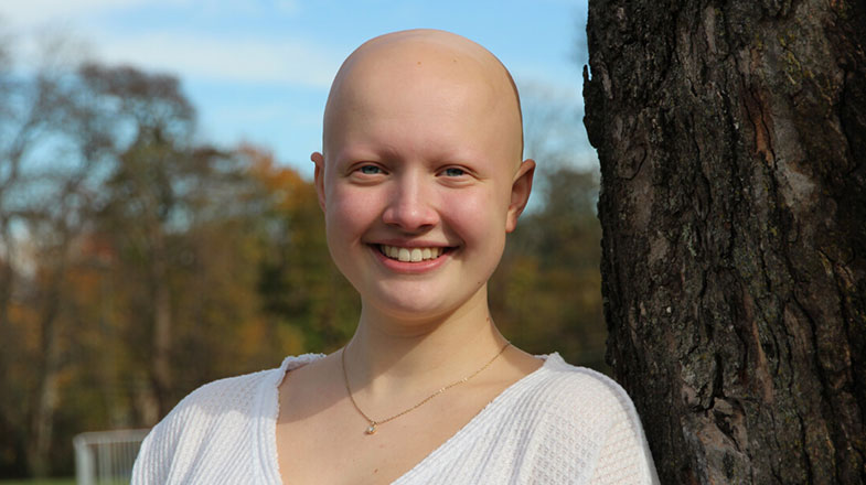 Living with Alopecia: A Young Woman’s Path to Self-Acceptance