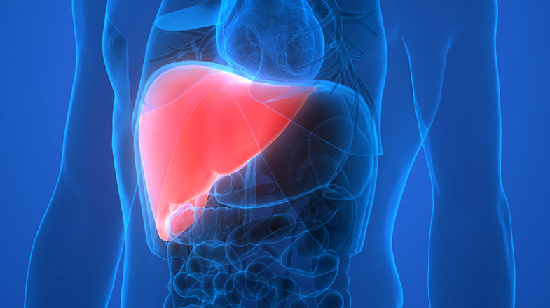 What You Need to Know About This Silent Liver Disease Called NASH