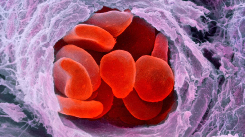 p2420151-red_blood_cells-spl.jpg