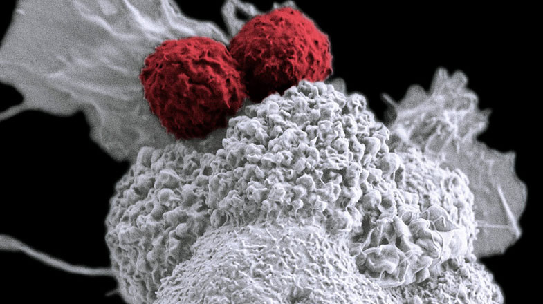 Media Name: t_cells_attacking_cancer_cell_775x716.jpg