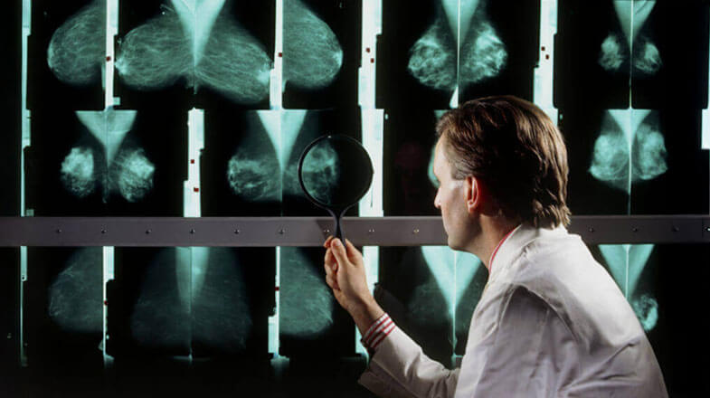 Breast cancer x-ray examination thumbnail