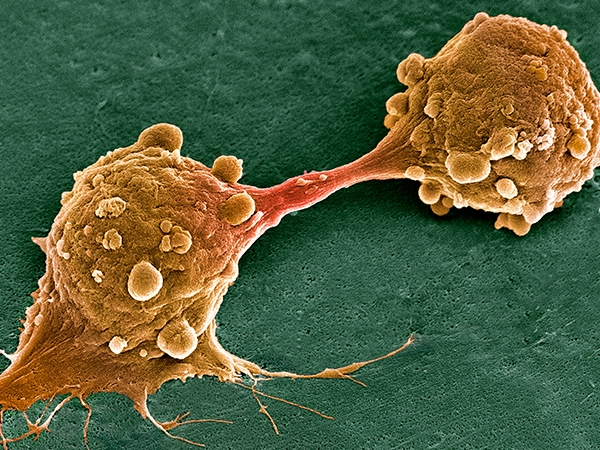 Cancer cells