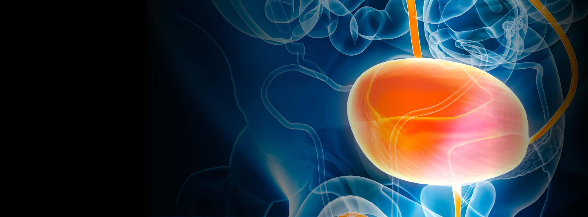   bladder cancer banner

