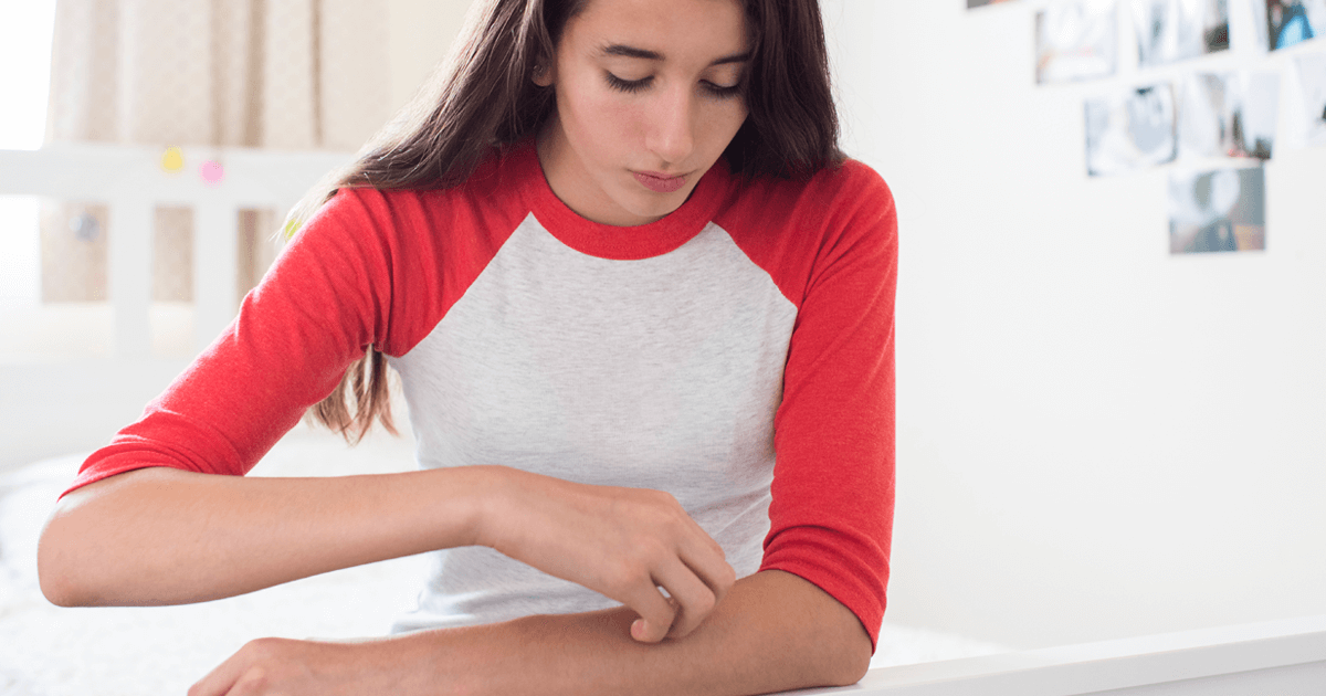 Eczema vs. Psoriasis: What’s Causing My Itchy Skin?