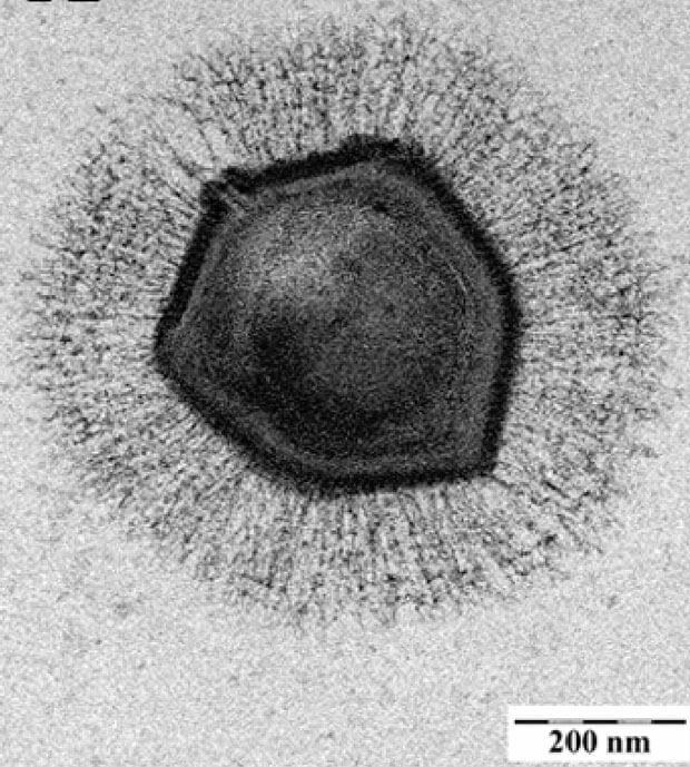 electron_microscopic_image_of_a_mimivirus image