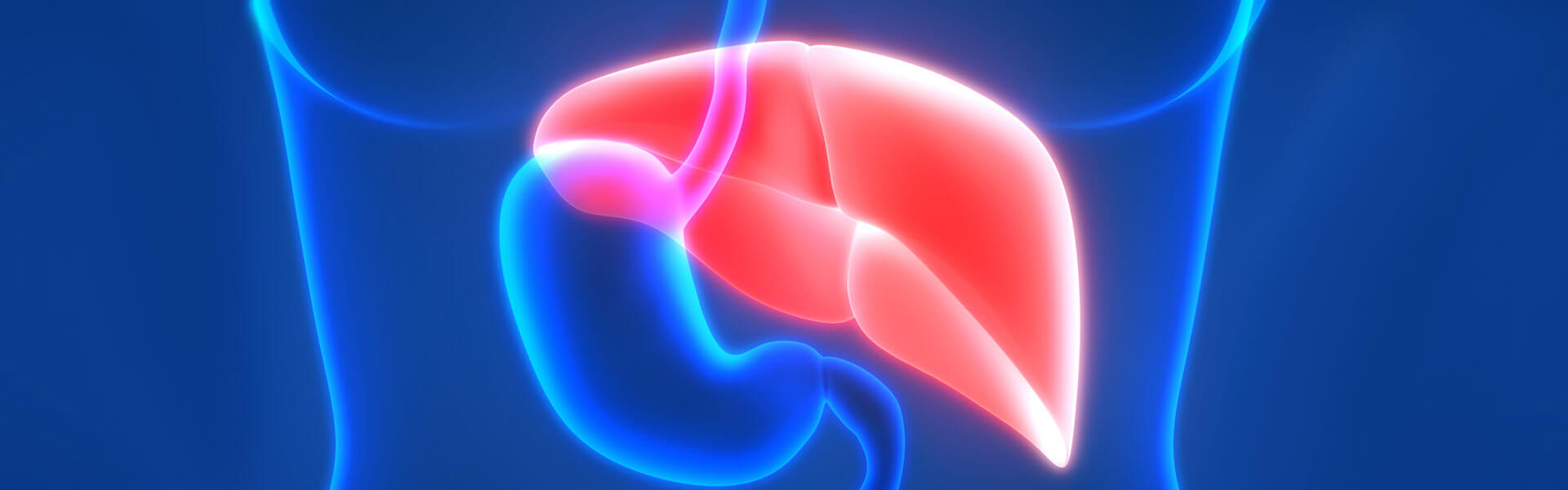 The Growing Epidemic of Non-alcoholic Steatohepatitis (NASH) Fatty Liver Disease