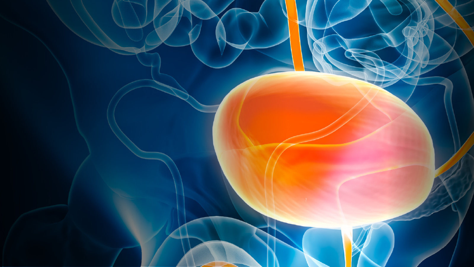Bladder cancer image