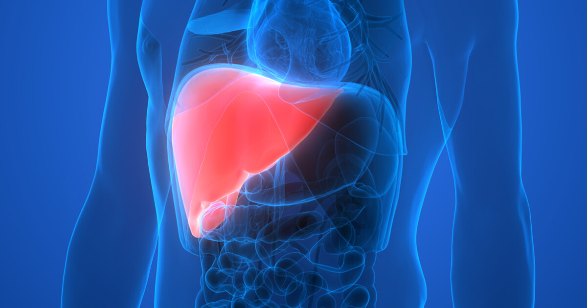 What You Need to Know About This Silent Liver Disease Called NASH