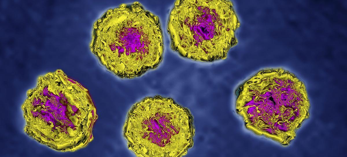 Meet the Common Viruses Now Used to Help Combat Cancer Pfizer