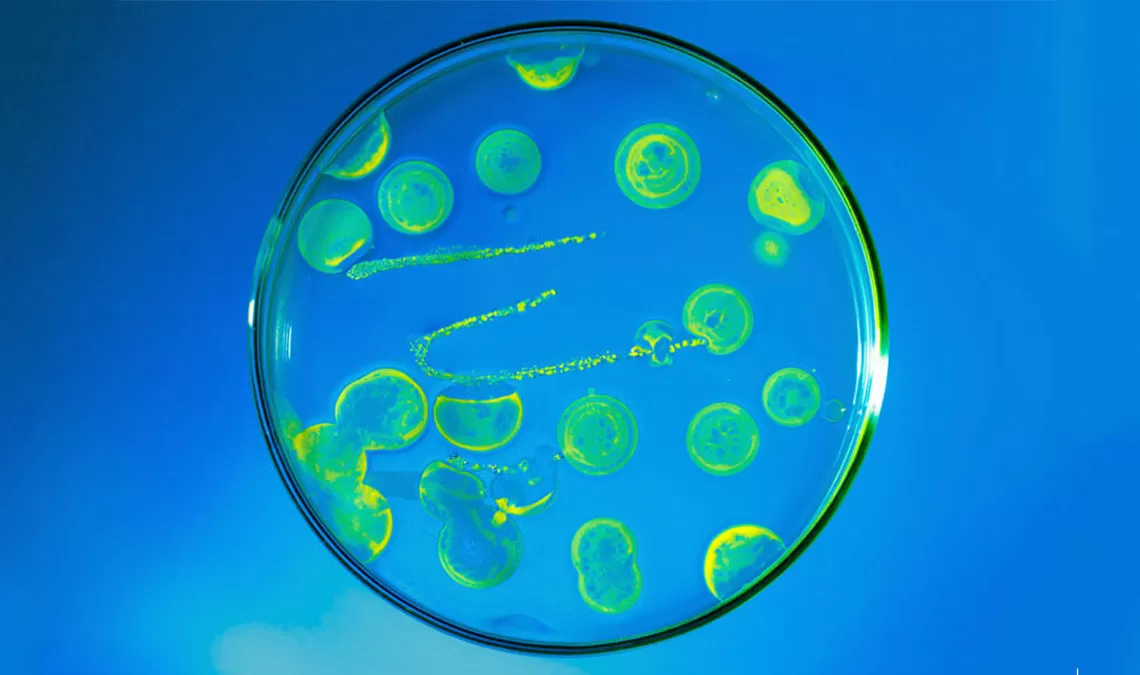 about_anti_infectives_1140X675.jpg