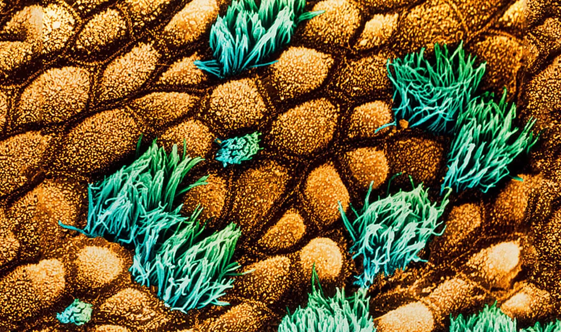 et-science_phenotypic-screening_1140X675.jpg