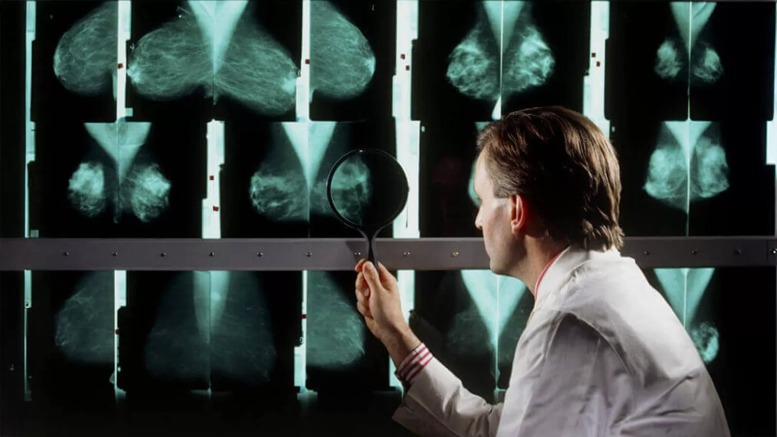 Breast cancer x-ray examination