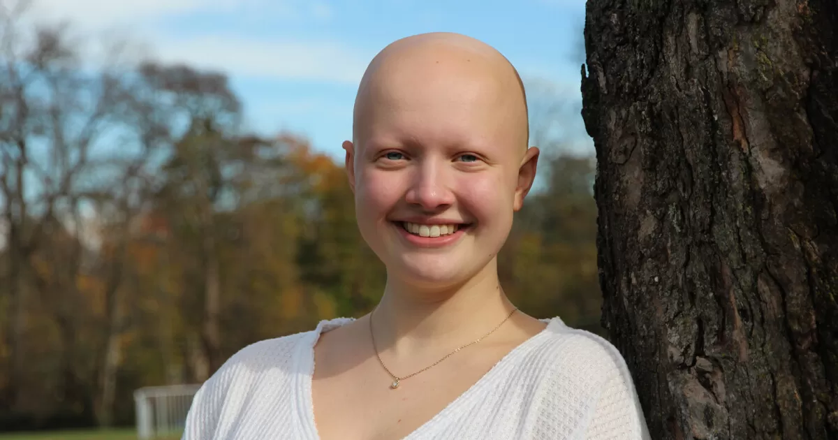 living-with-alopecia_1_0.jpg