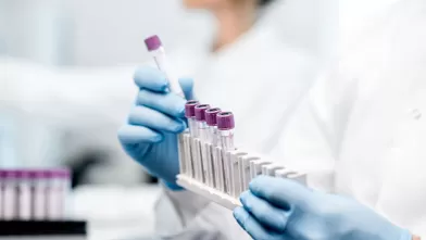 science image lab technician holding vials