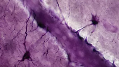 Seizing upon a ‘Special Sauce’ of Drug Development to Fight Cancer in the Brain