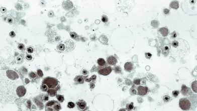Advances in Cytomegalovirus Vaccine Development