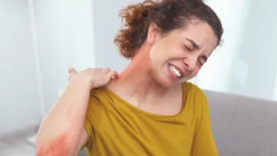 Eczema: More Than Just a Skin Condition
