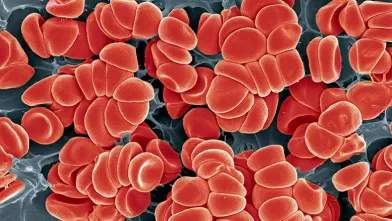 Hemophilia Q&A