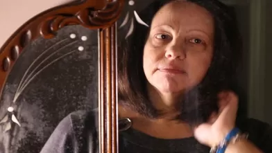 Not Just Cosmetic: The Pain of Alopecia and the Search for A Cure 