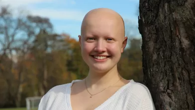Living with Alopecia: A Young Woman's Path to Self-Acceptance