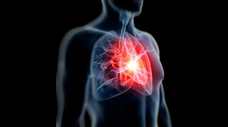 internal_medicine_785X440.jpg