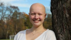 Living with Alopecia: A Young Woman's Path to Self-Acceptance