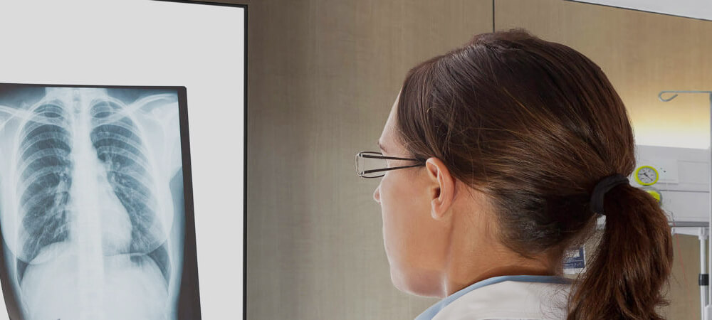 Pulmonary Hypertension Tile