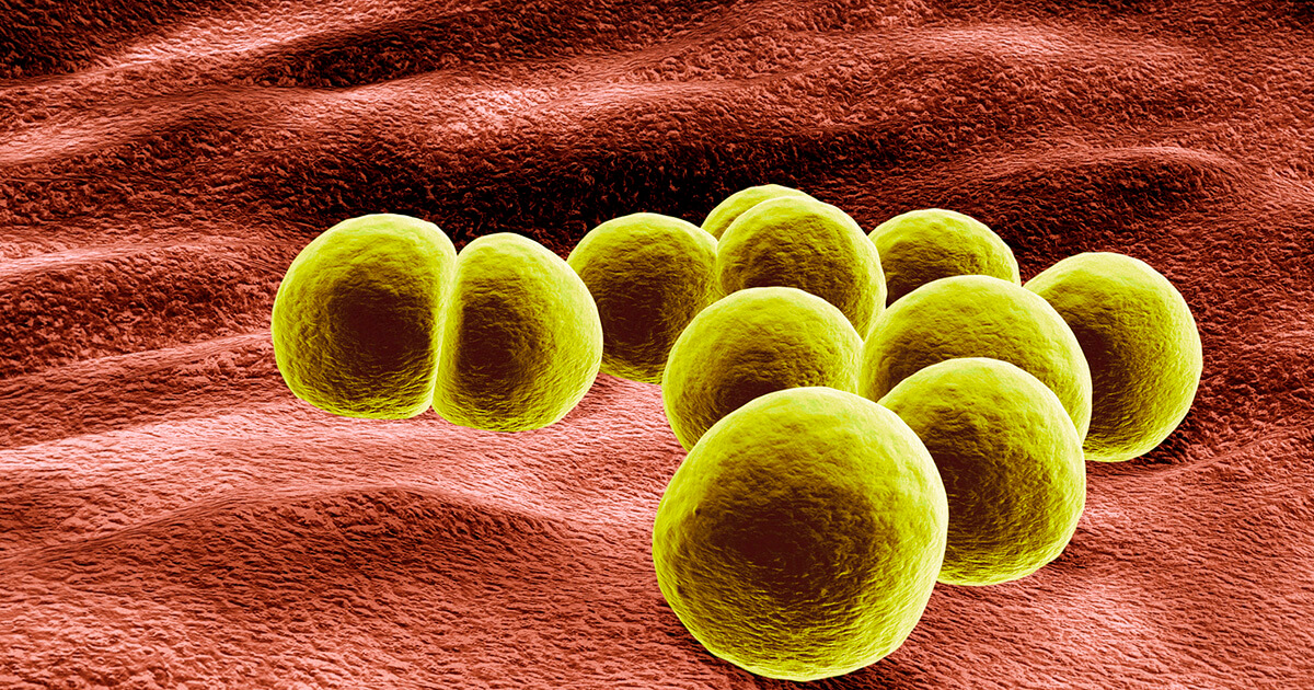 What You Need to Know About MRSA